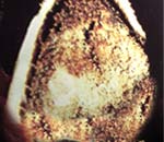 Разлом луковицы гиппеаструма пораженной корневыми клещами